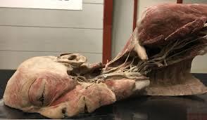 Anatomisches Ganzkörperpräparat